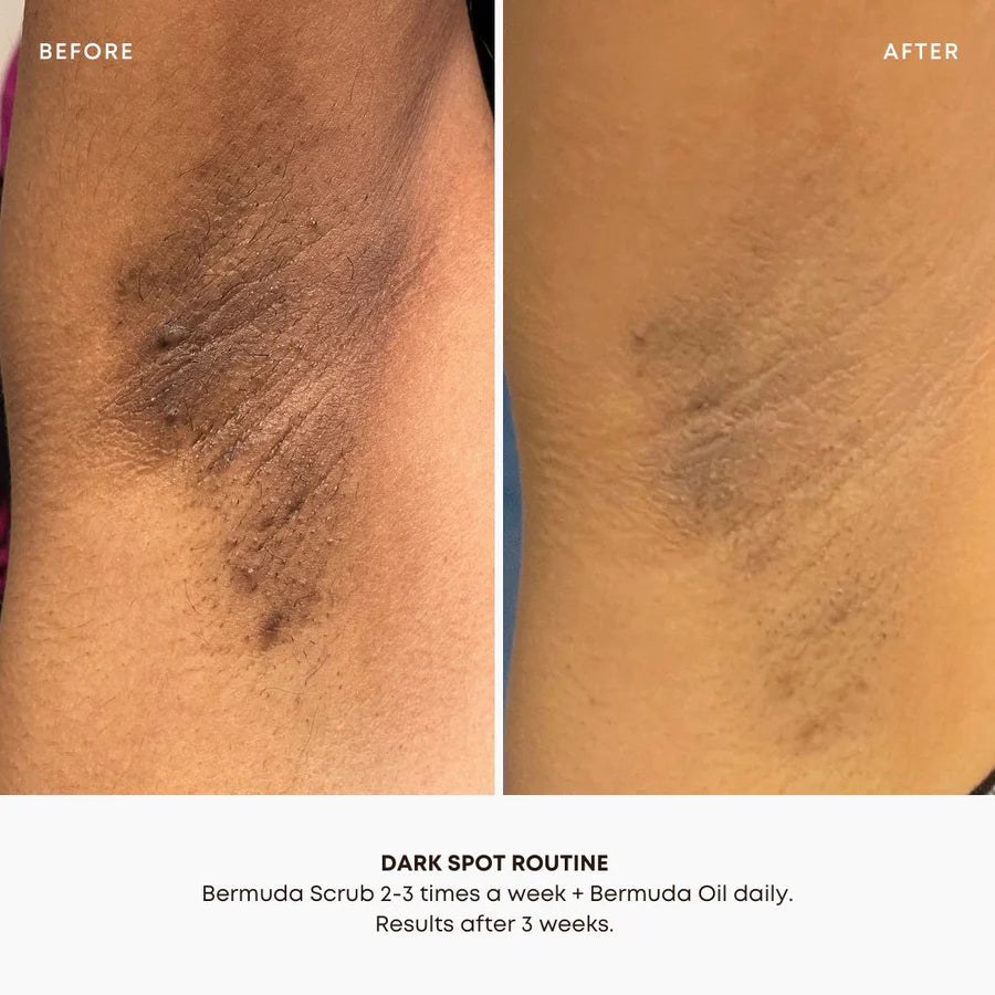 Dark Spot 2 Step Routine