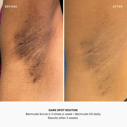 Dark Spot 2 Step Routine