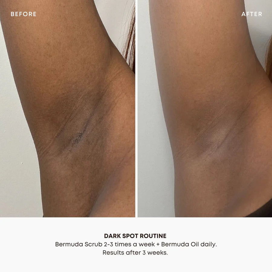 Bermuda Dark Spot Oil