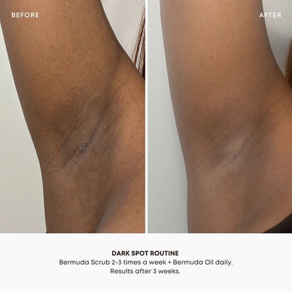 Dark Spot 2 Step Routine
