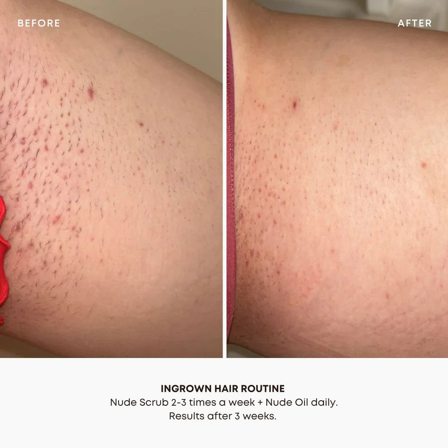 Ingrown Hair 2 Step Routine
